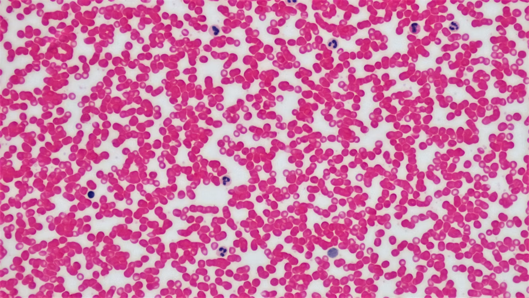 Rote und weiße Blutkörperchen unter dem Mikroskop. Studien zu Long Covid und ME/CFS untersuchen unter anderem mögliche Veränderungen in Mikrozirkulation und Blutgefäßen. (Foto: Unsplash)